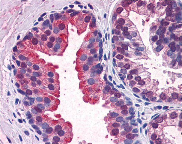 Anti-KEAP1 (AB1) antibody produced in rabbit