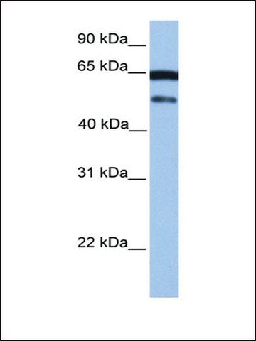 Anti-HCG_2042202 antibody produced in rabbit