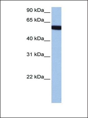 Anti-HCG_1646157 (AB2) antibody produced in rabbit