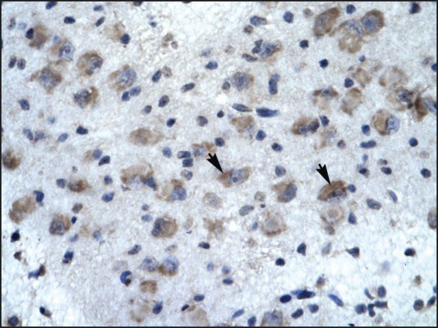 Anti-KCNH5 (AB1) antibody produced in rabbit