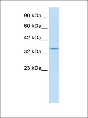 Anti-KCNAB2 (AB2) antibody produced in rabbit