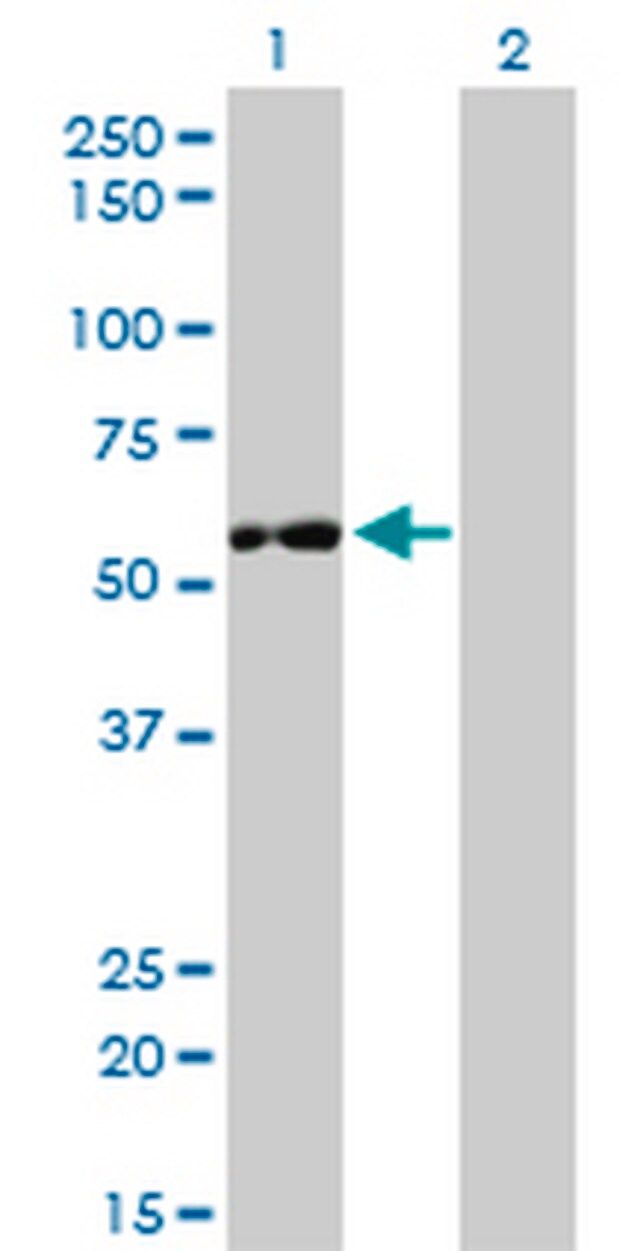 Anti-IMPDH2 Mouse mAb (1E12-B6)