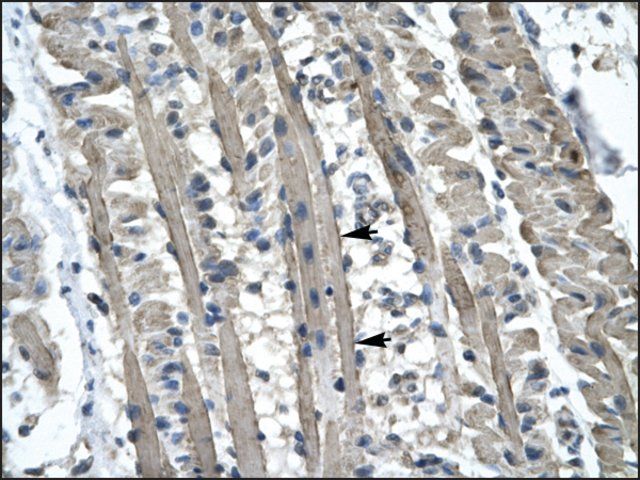 Anti-KIF5B (AB2) antibody produced in rabbit