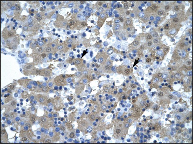 Anti-KIF5B (AB1) antibody produced in rabbit