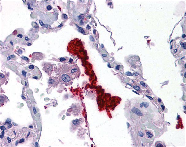 Anti-KLK6 antibody produced in rabbit