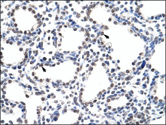 Anti-KIAA0020 antibody produced in rabbit