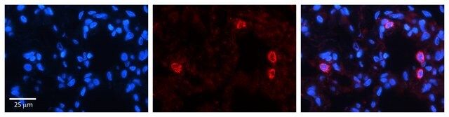 Anti-NFATC4 (AB2) antibody produced in rabbit