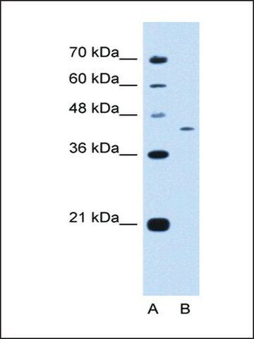 Anti-KIAA0515 antibody produced in rabbit