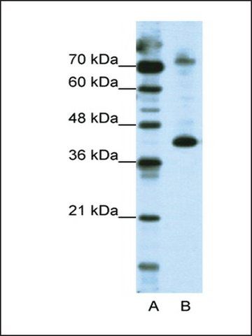 Anti-NKRF antibody produced in rabbit