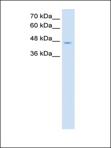 Anti-NDRG1 (AB1) antibody produced in rabbit