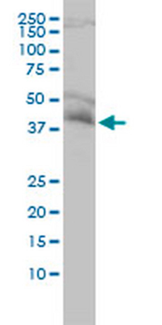 Anti-NDE1 Mouse mAb (2G11-1C11)