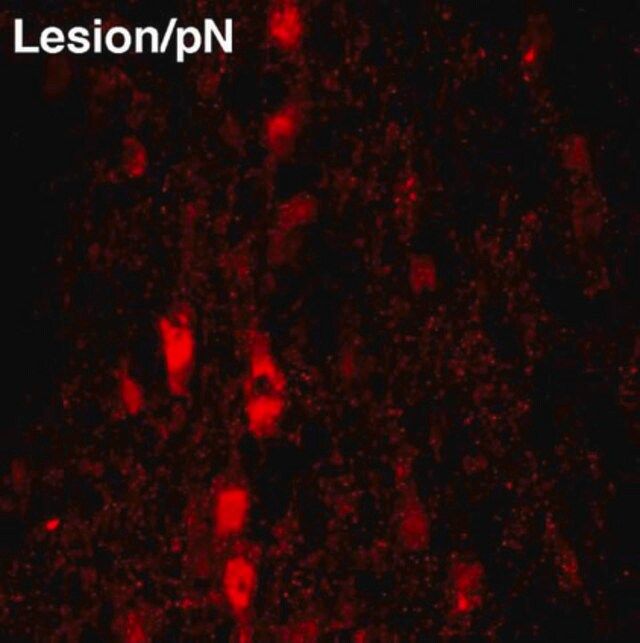 Anti-Nerve Growth Factor Antibody, pro