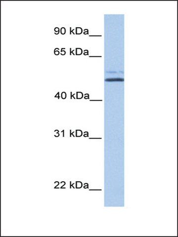 Anti-NHEDC2 antibody produced in rabbit