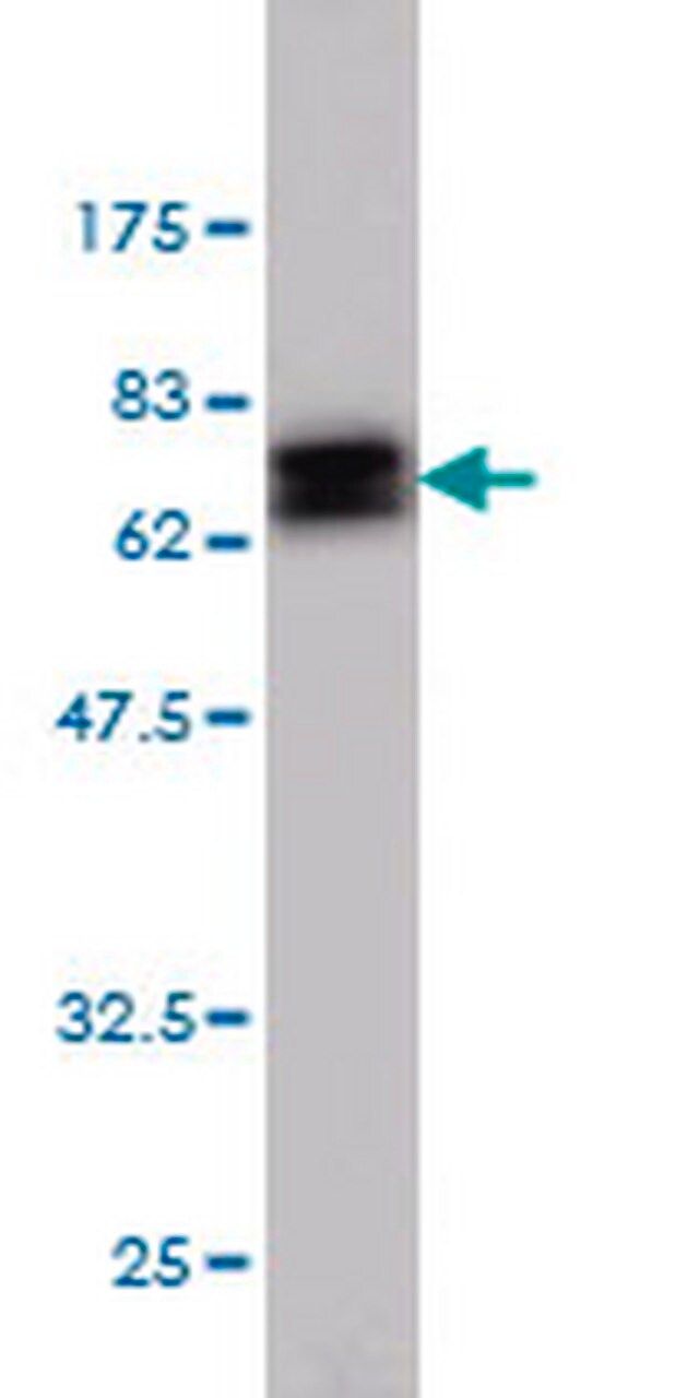 Anti-NDRG1 Mouse mAb (2D7)