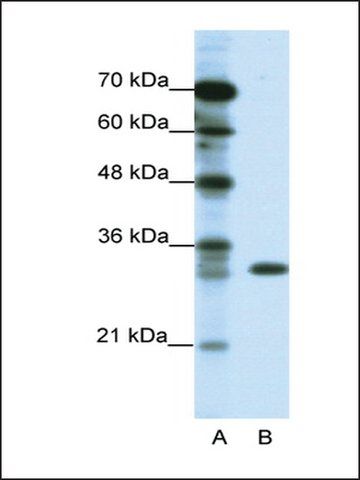 Anti-TSFM (AB2) antibody produced in rabbit