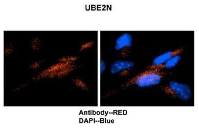 Anti-UBE2N (AB2) antibody produced in rabbit