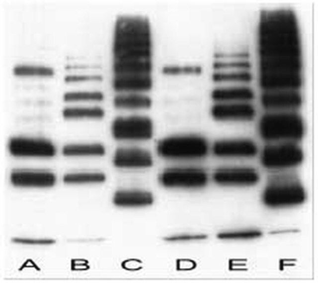 Anti-Ubiquitin Mouse mAb (FK2)