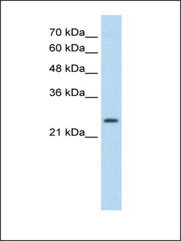 Anti-TSHR (AB2) antibody produced in rabbit