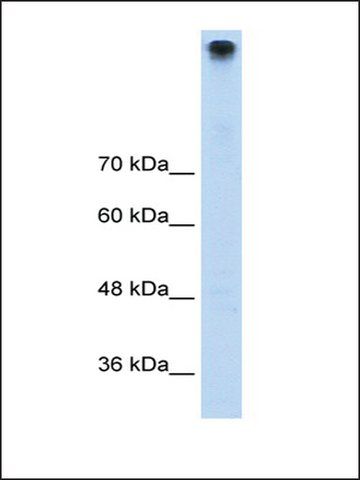 Anti-TRPM3 (AB3) antibody produced in rabbit