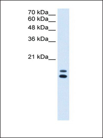 Anti-UXT (AB2) antibody produced in rabbit