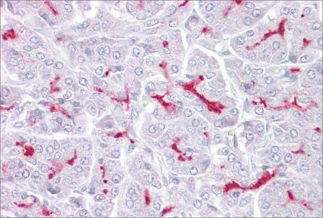 Anti-TRPM5 (AB1) antibody produced in rabbit