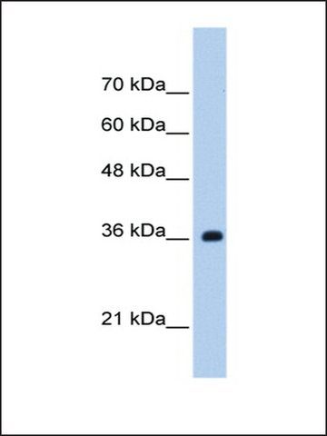 Anti-TRSPAP1 antibody produced in rabbit