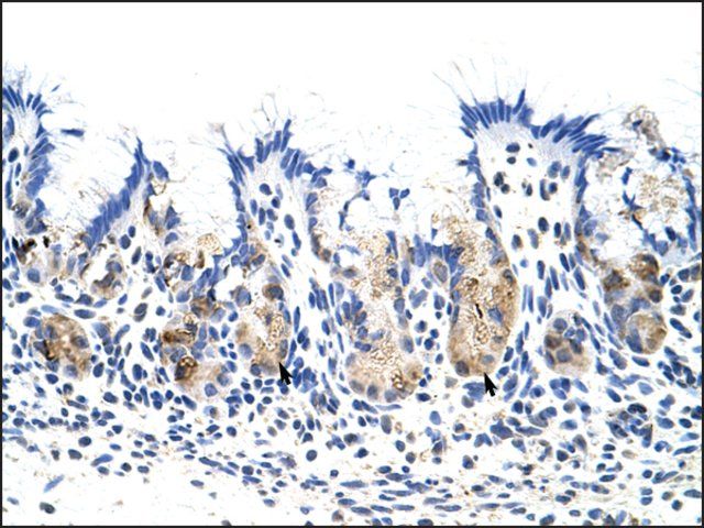 Anti-TROVE2 (AB1) antibody produced in rabbit