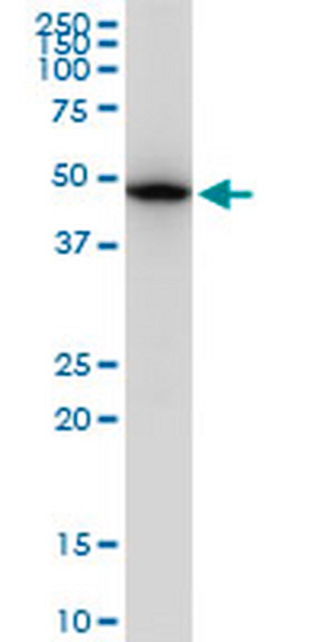 Anti-TUBB2A Mouse mAb (2B2)