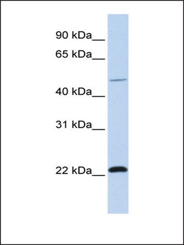 Anti-WWP2 (AB2) antibody produced in rabbit