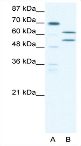 Anti-ZNF297B (AB2) antibody produced in rabbit