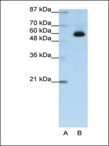 Anti-ZNF307 (AB3) antibody produced in rabbit