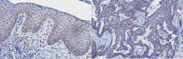 Anti-Vitamin D receptor Antibody, clone 9A7