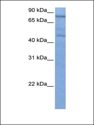 Anti-ZNF555 (AB4) antibody produced in rabbit