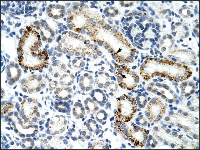 Anti-ZRSR2 antibody produced in rabbit