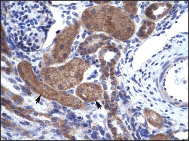 Anti-ZNFN1A2 antibody produced in rabbit