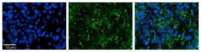 Anti-ZDHHC17 (AB1) antibody produced in rabbit