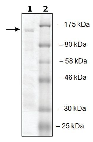 RNF20 active human