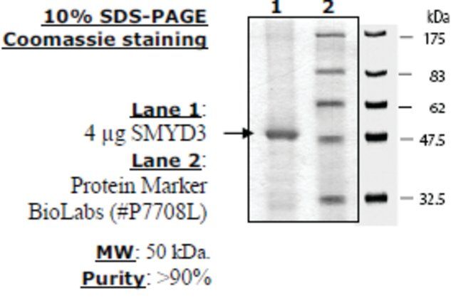 SMYD3 (full length) Active human