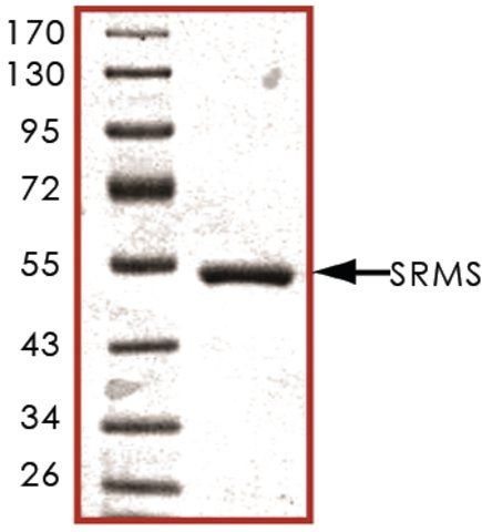 SRMS, active, GST tagged human