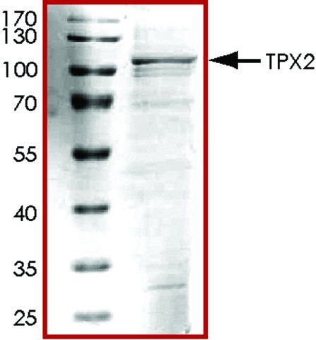 TPX2, His tagged human