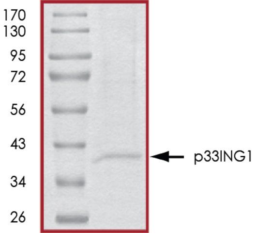 p33ING1, His tagged human