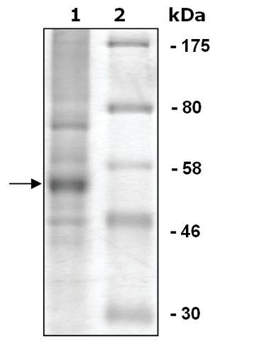 PHF8 human