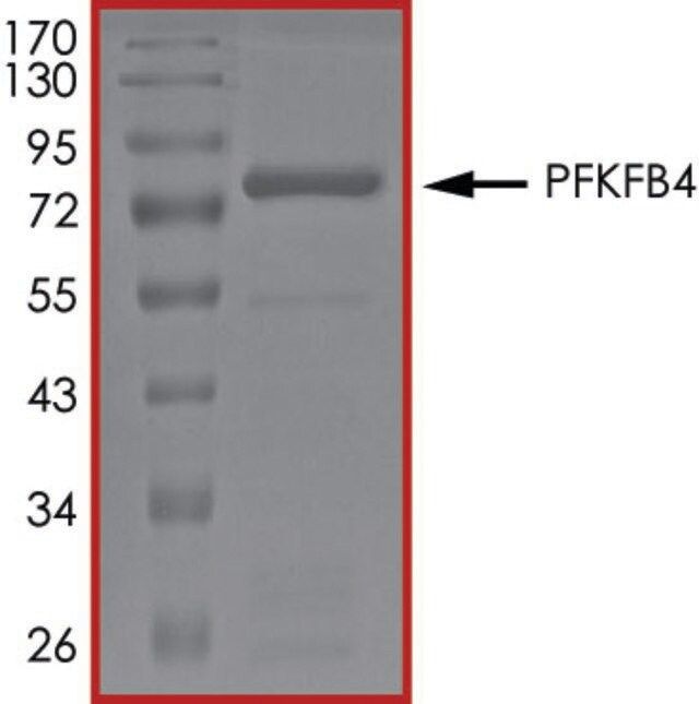 PFKFB4 Protein