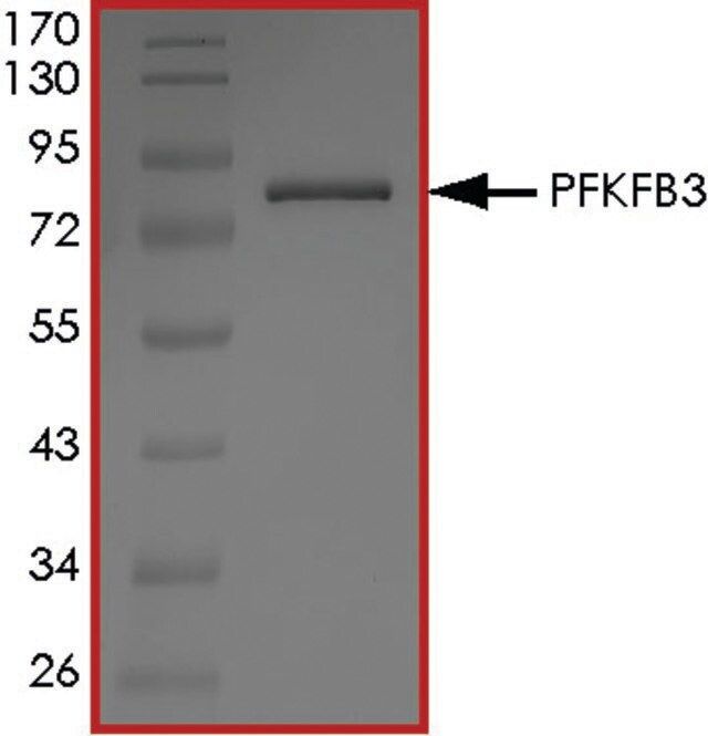 PFKFB3 Protein