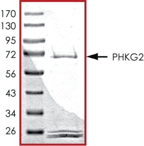 PHKG2, active, GST tagged human