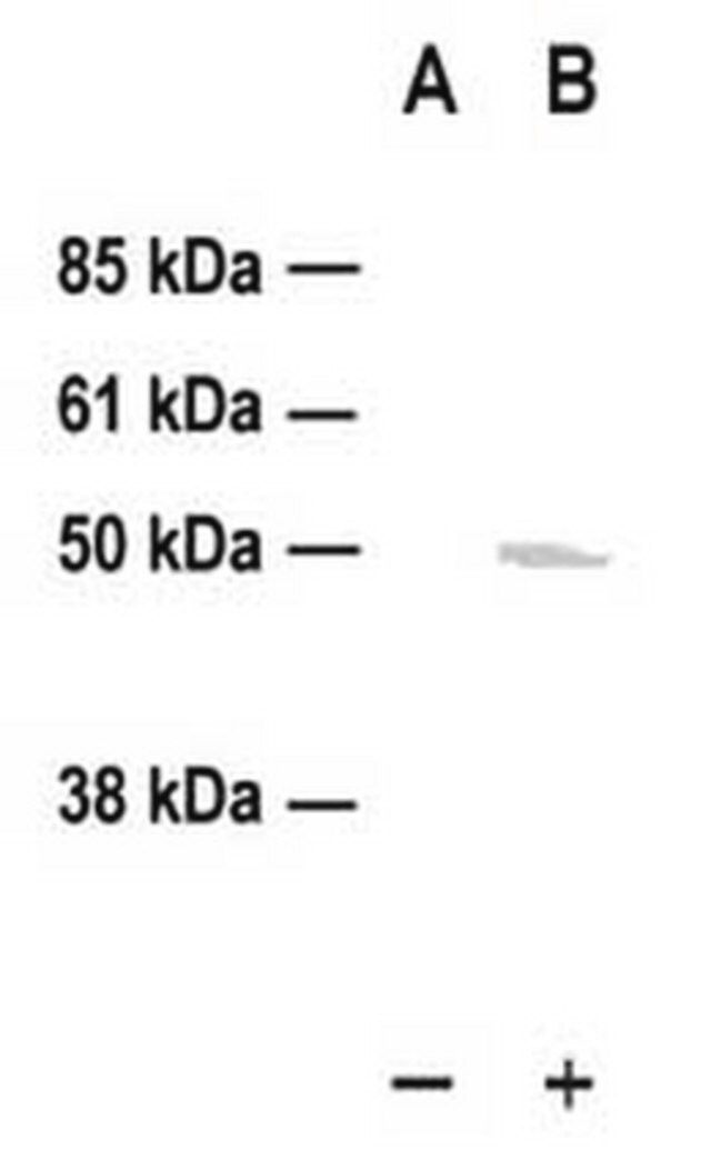 PhosphoDetect Anti-p53 (pSer<sup>1</sup><sup>5</sup>) (Ab-3) Rabbit pAb