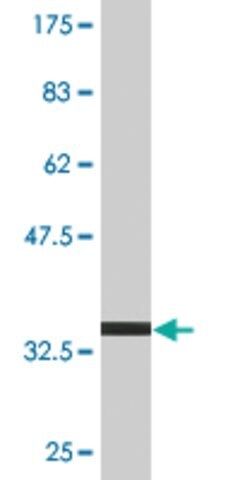 Monoclonal Anti-TPD52 antibody produced in mouse