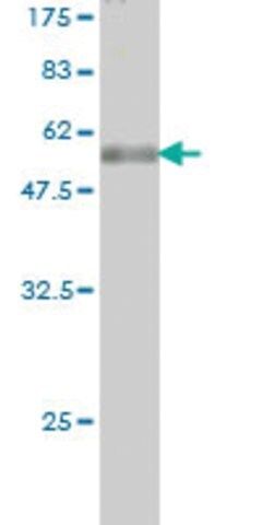 Monoclonal Anti-TPMT antibody produced in mouse