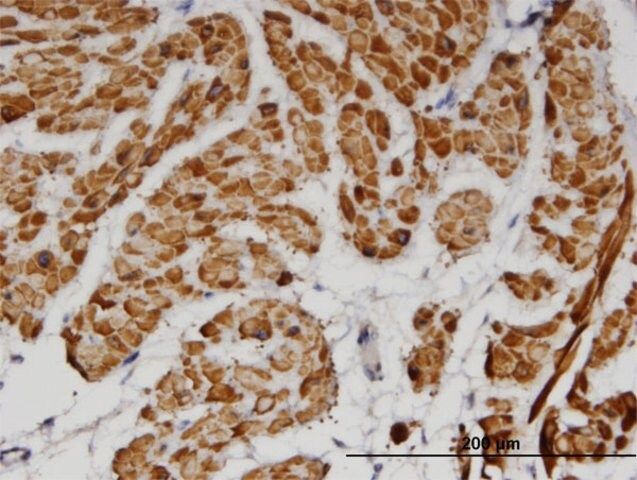 Monoclonal Anti-TPM2 antibody produced in mouse