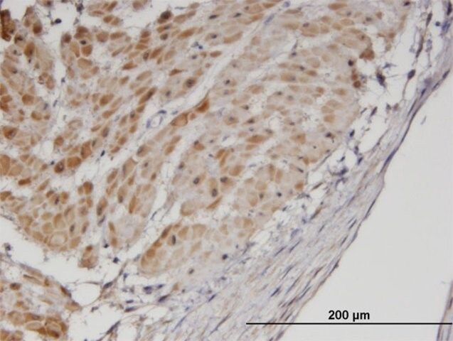 Monoclonal Anti-TPM3 antibody produced in mouse